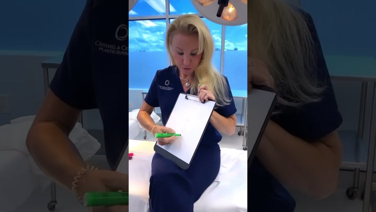 Dr. Kara Criswell Discusses the Labiaplasty Procedure