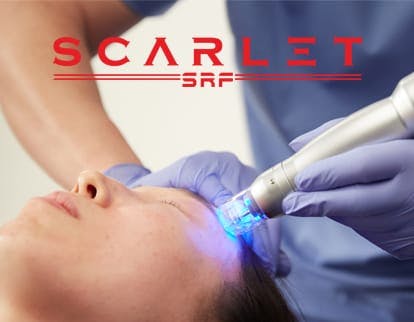 person getting microneedling