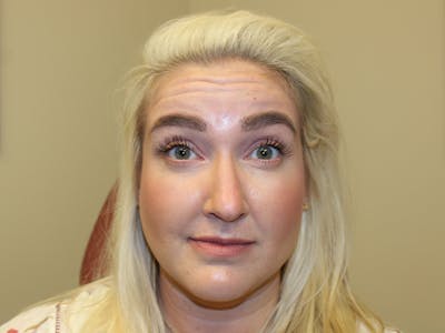 Letybo Before & After Gallery - Patient 121906 - Image 1