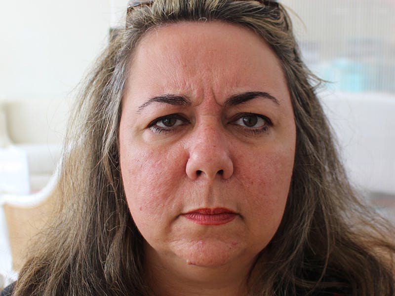 Letybo Before & After Gallery - Patient 378192 - Image 5