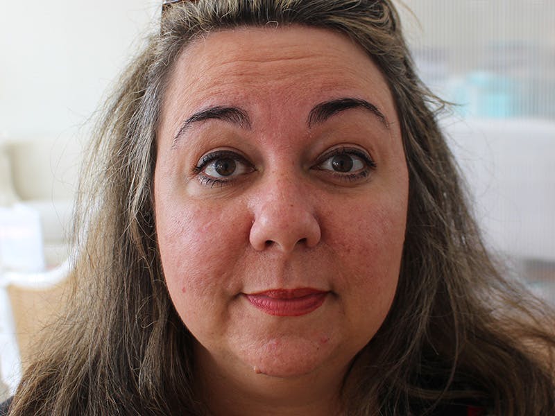 Letybo Before & After Gallery - Patient 378192 - Image 3