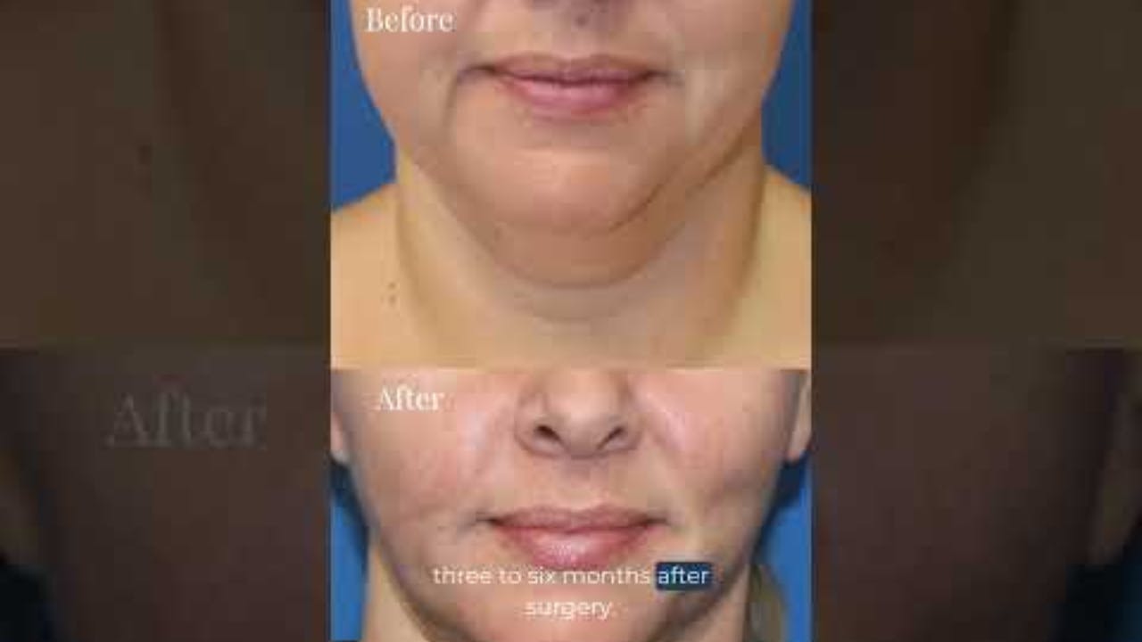 Criswell & Criswell Plastic Surgery & Medspa