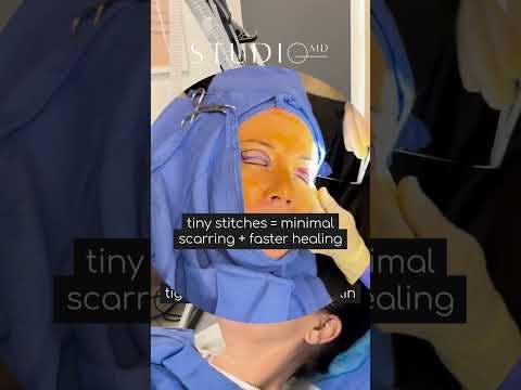 Blepharoplasty youtube screenshot