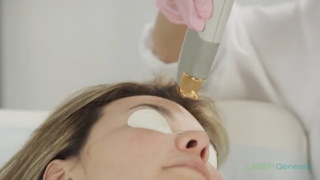 xeo Laser Genesis Treatment