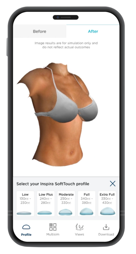 3D AI Treatment Simulator