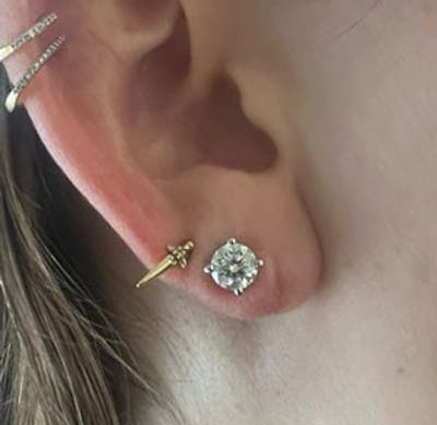 Torn Earlobe Repair Before & After Gallery - Patient 171413 - Image 2