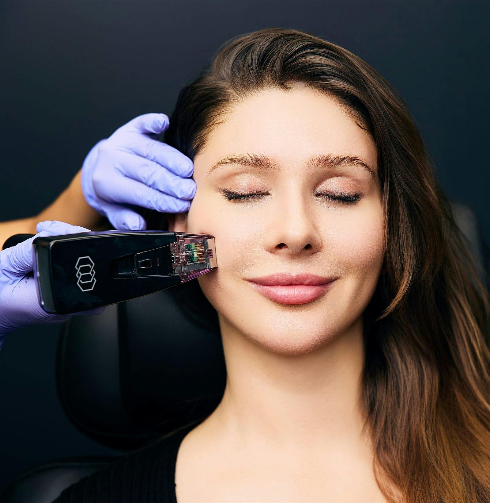 woman recieving a Morpheus8 treatment