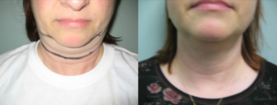 patient results