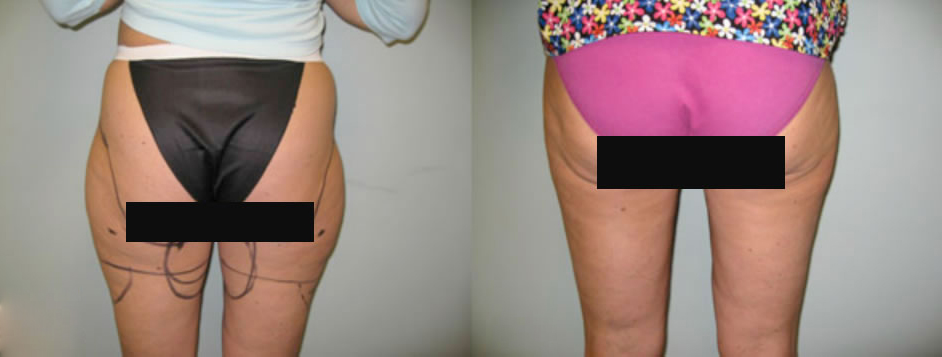 patient results