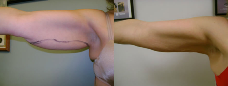 patient results