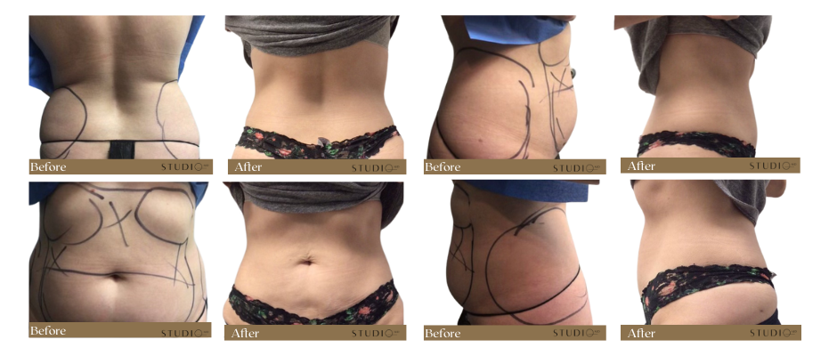 patient results