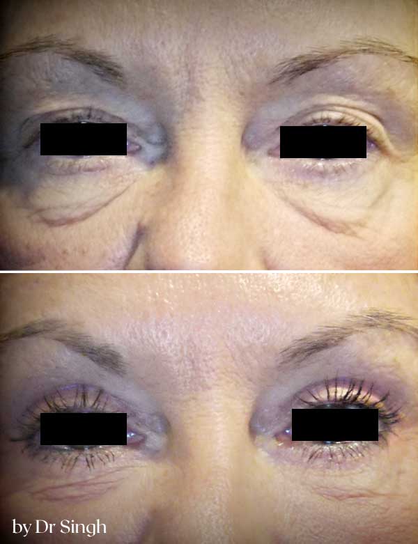 patient results