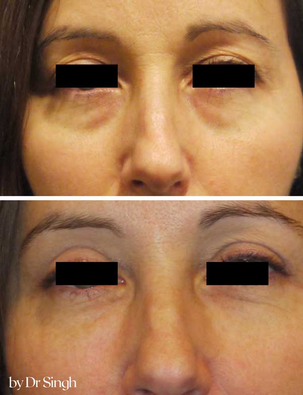 patient results