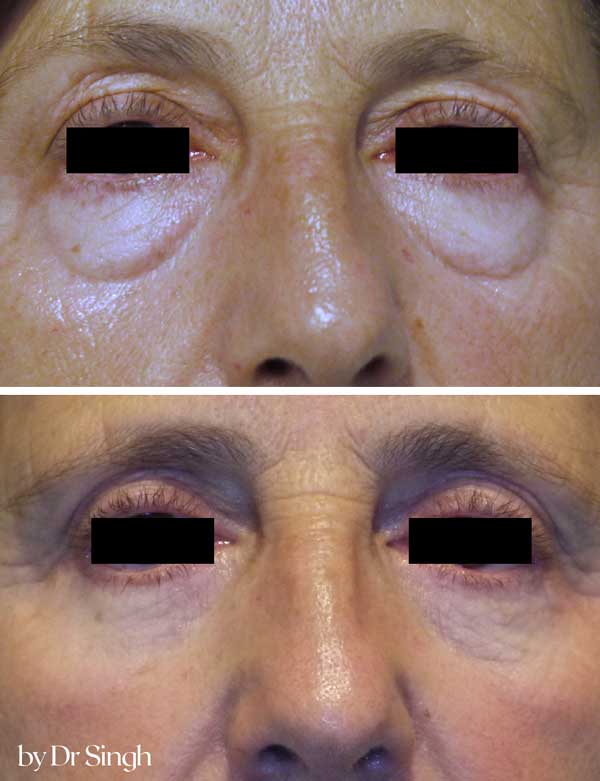patient results