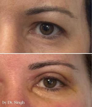 patient results