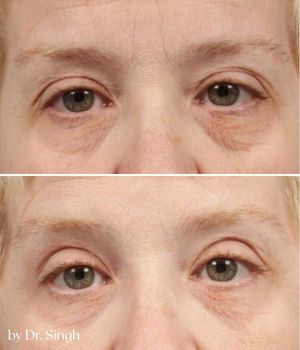 patient results