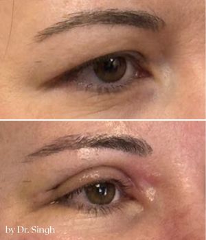 patient results