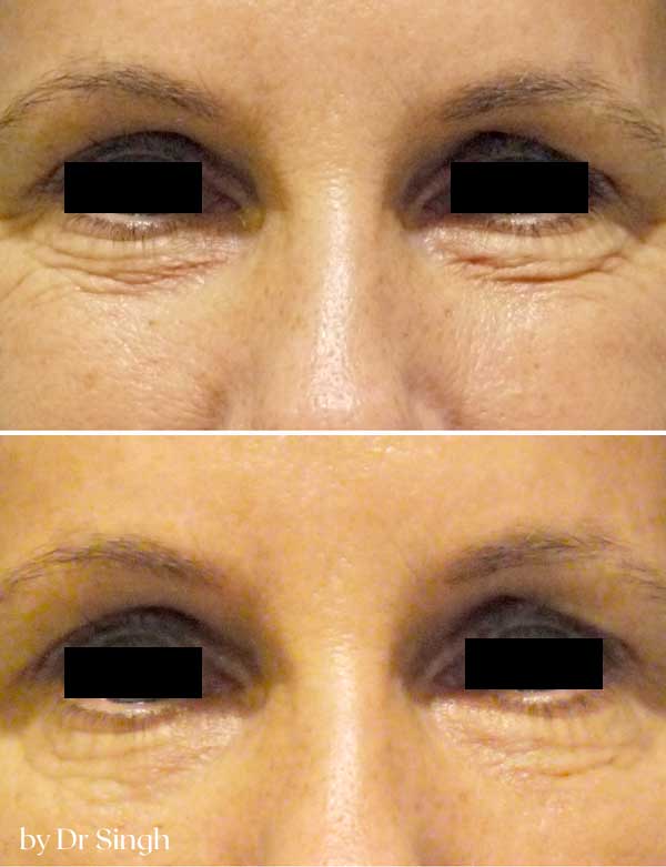 patient results