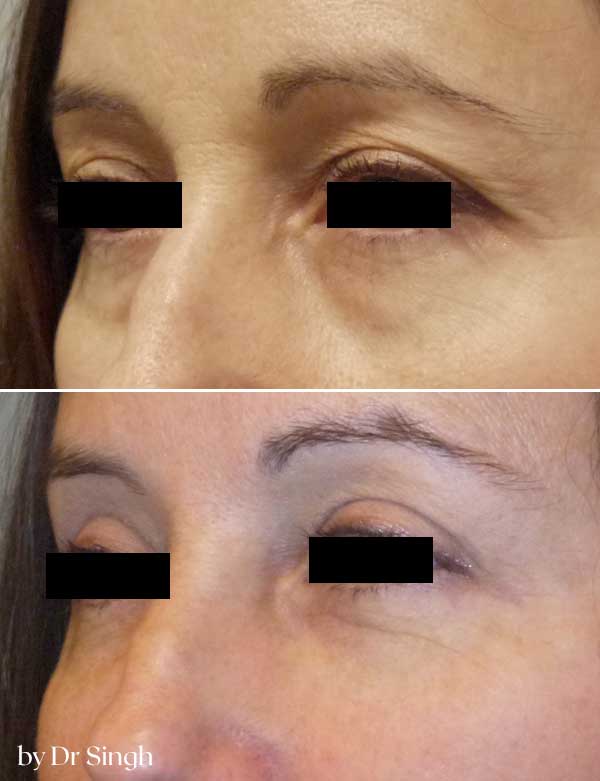 patient results