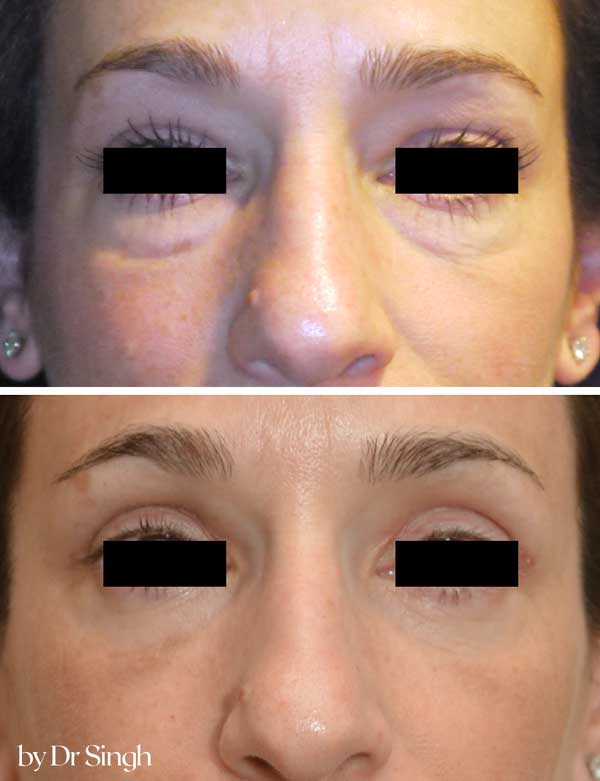 patient results