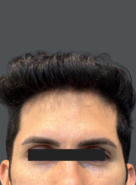 procedure