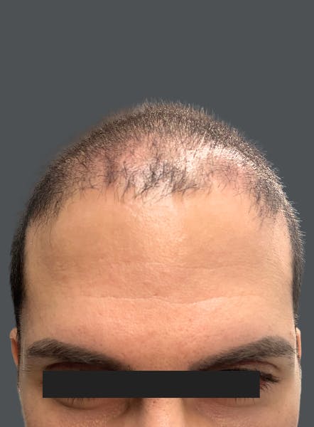 procedure
