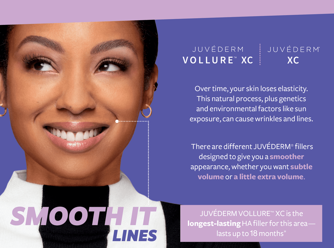 JUV&Eacute;DERM&reg; VOLLURE&trade; XC