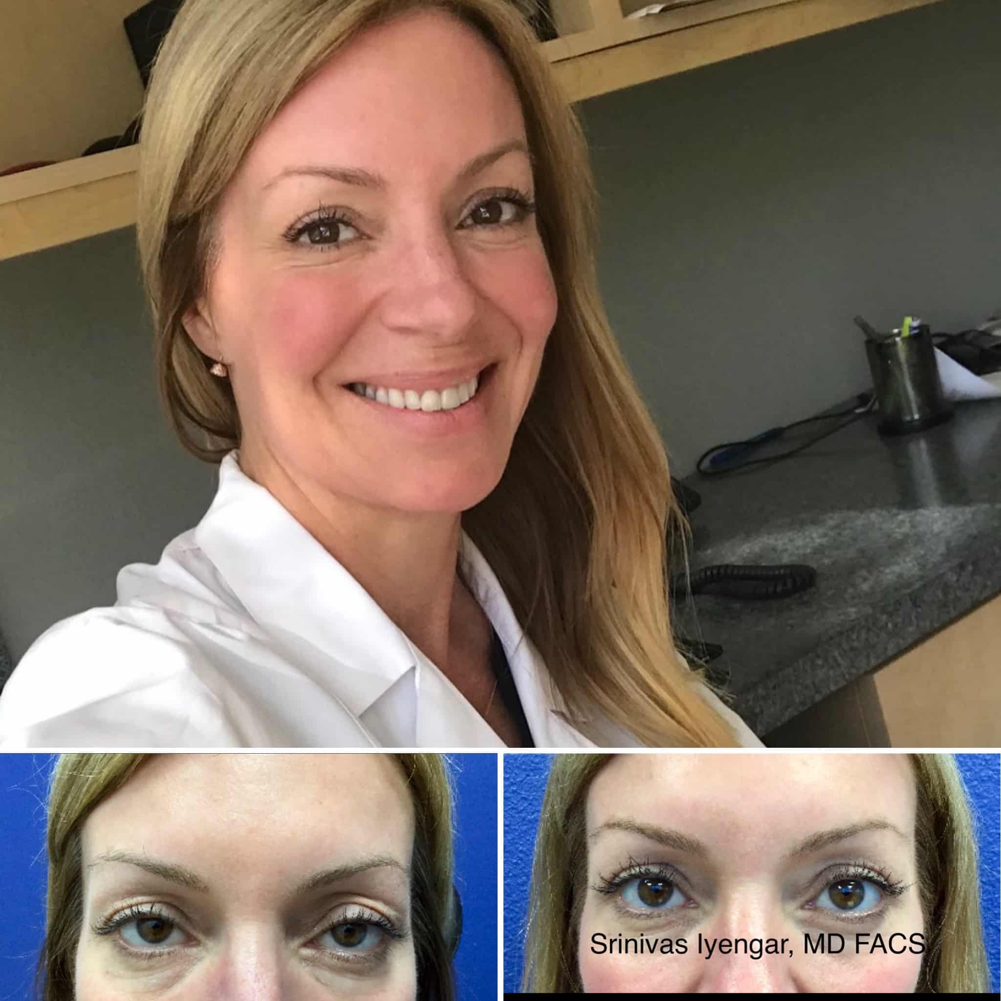 San Diego Eyelid Specialists Blog | Where Can I Have My Eyelid Surgery If I Live In Del Mar Or Poway?