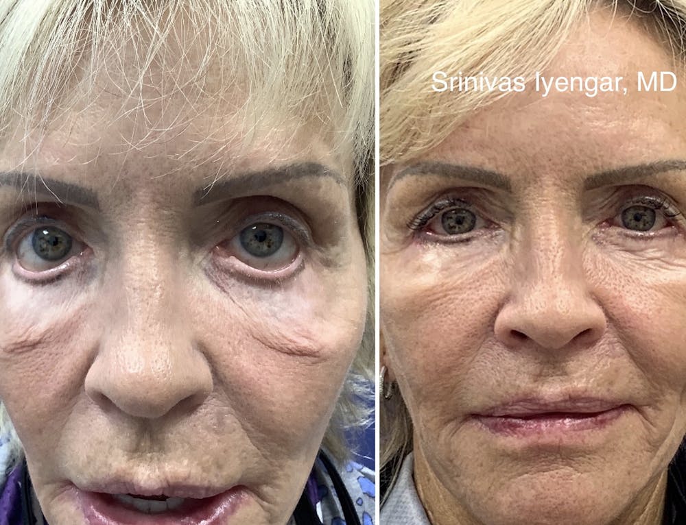 91061b86 7167 41a8 bc6b 97579a6750b2