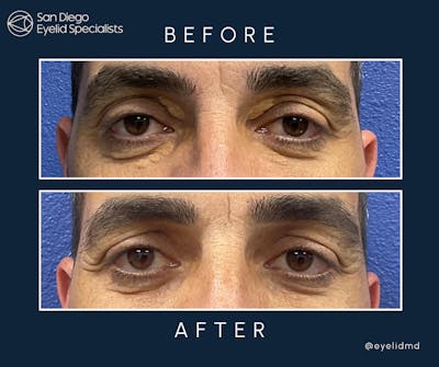 Reconstructive Before & After Gallery - Patient 754543 - Image 1