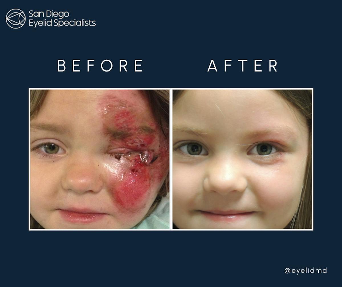 Reconstructive Before & After Gallery - Patient 660829 - Image 1