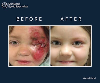 Reconstructive Before & After Gallery - Patient 660829 - Image 1