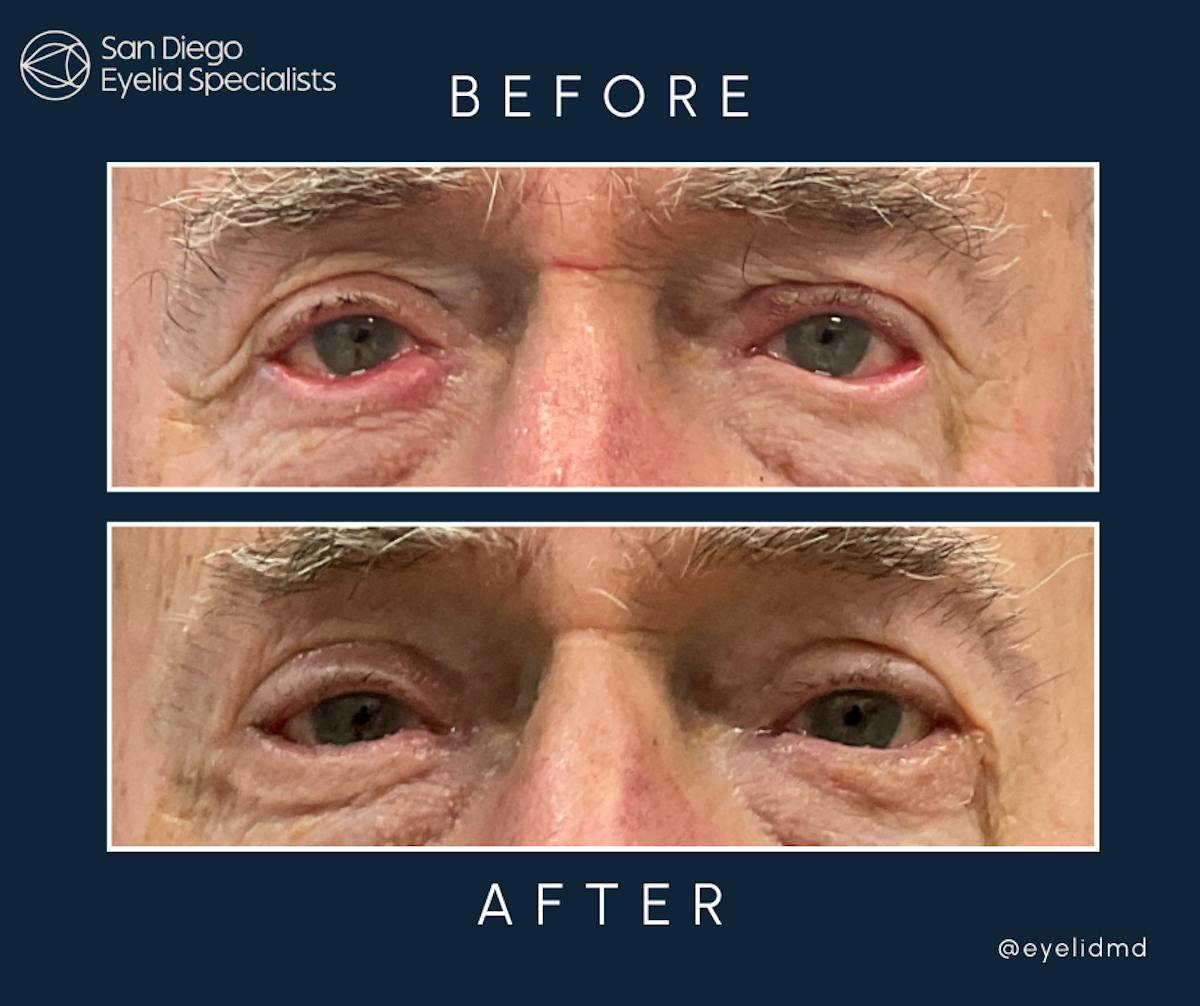 Reconstructive Before & After Gallery - Patient 354302 - Image 1