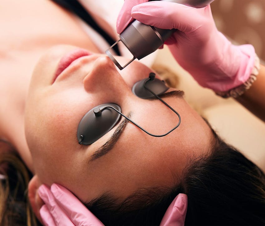 woman getting an IPL treatment