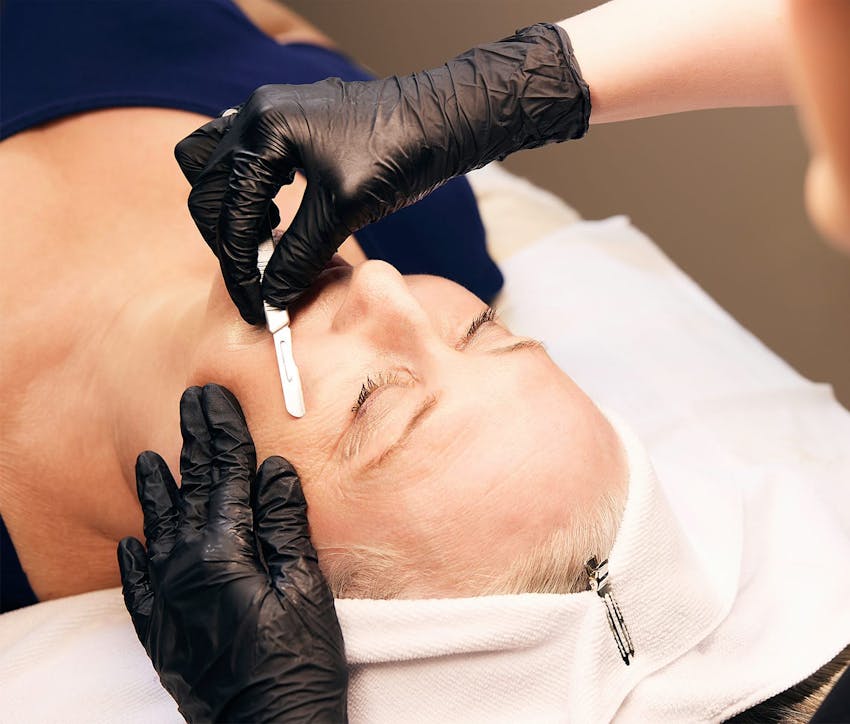 woman getting a dermaplane facial