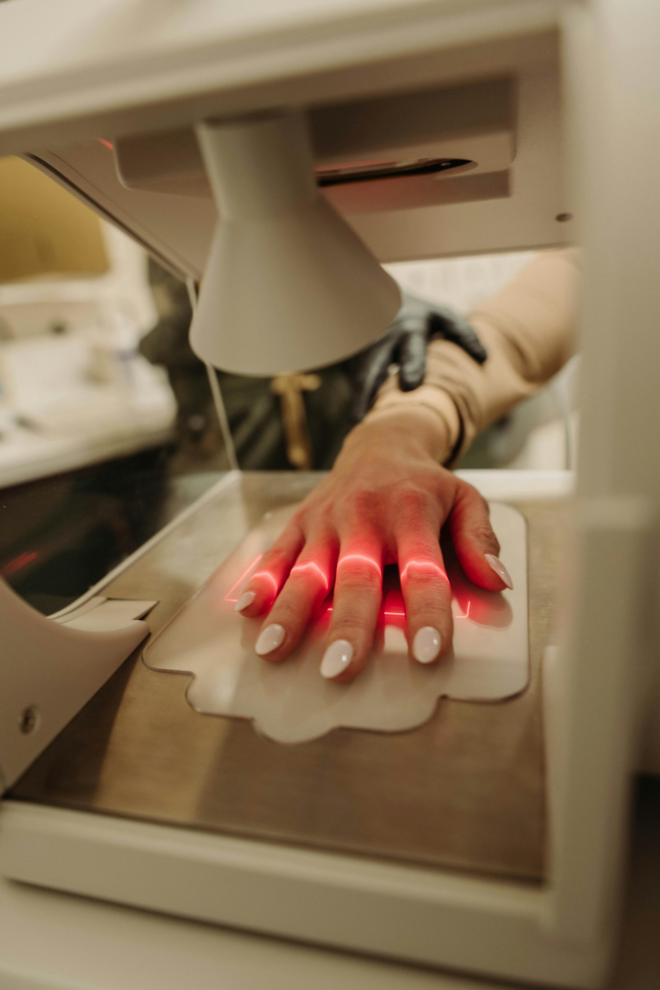 co2 hand rejuvination