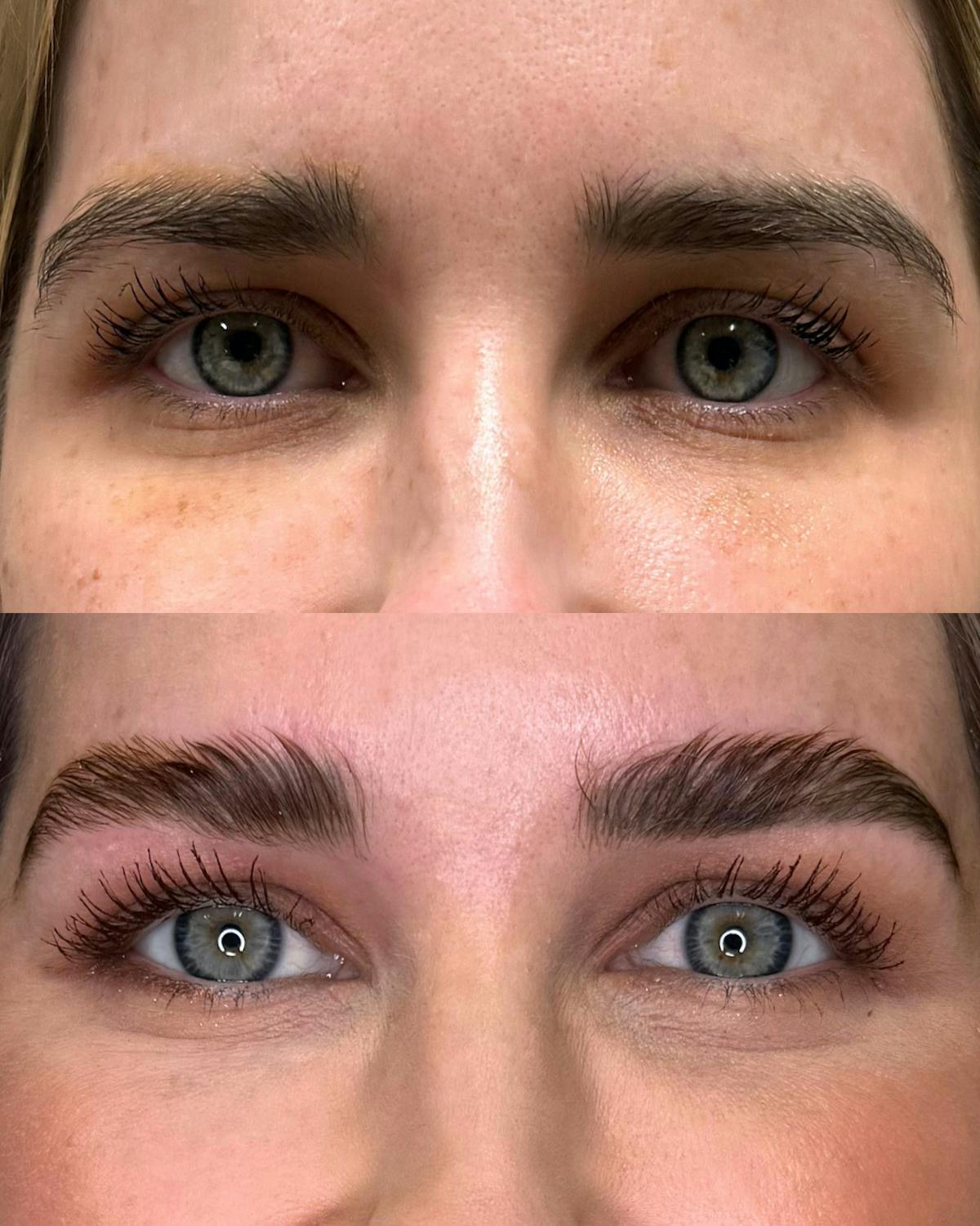 Brow Lamination Before & After Gallery - Patient 157749 - Image 1