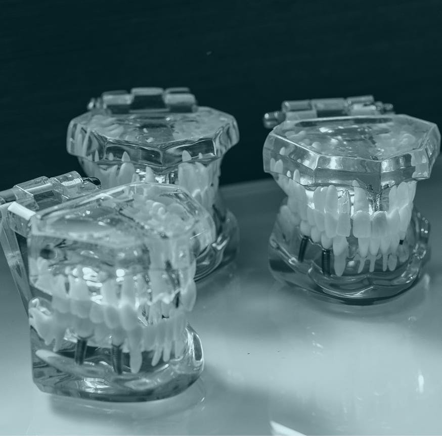 3 fake teeth examples