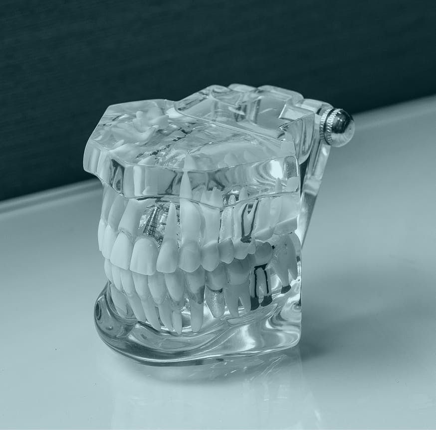 model of teeth