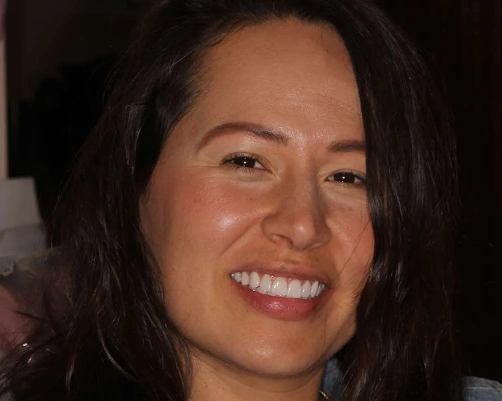 Patient one after procedure