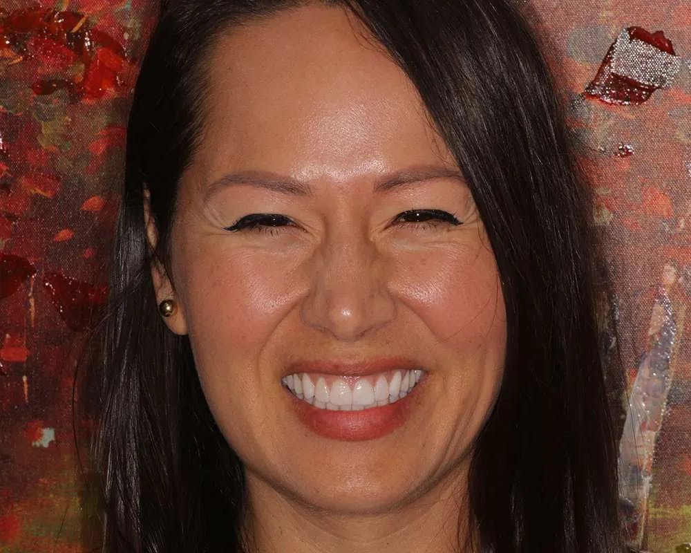 Patient one after procedure