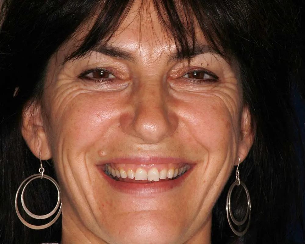 Patient three before image 2