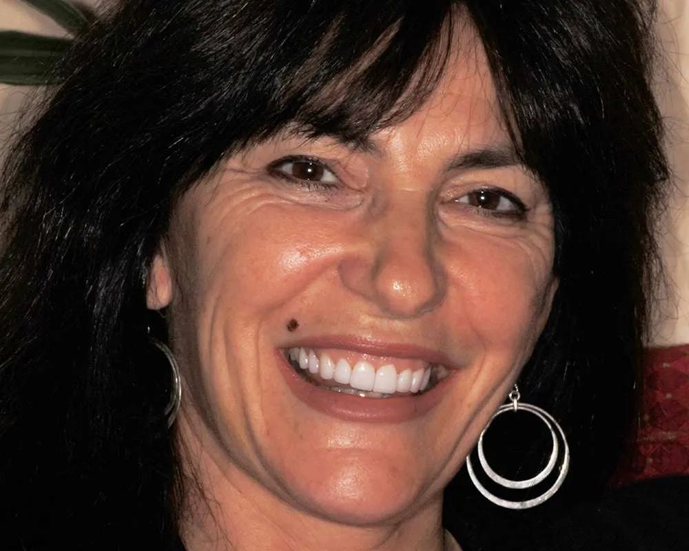 Patient three after image 2