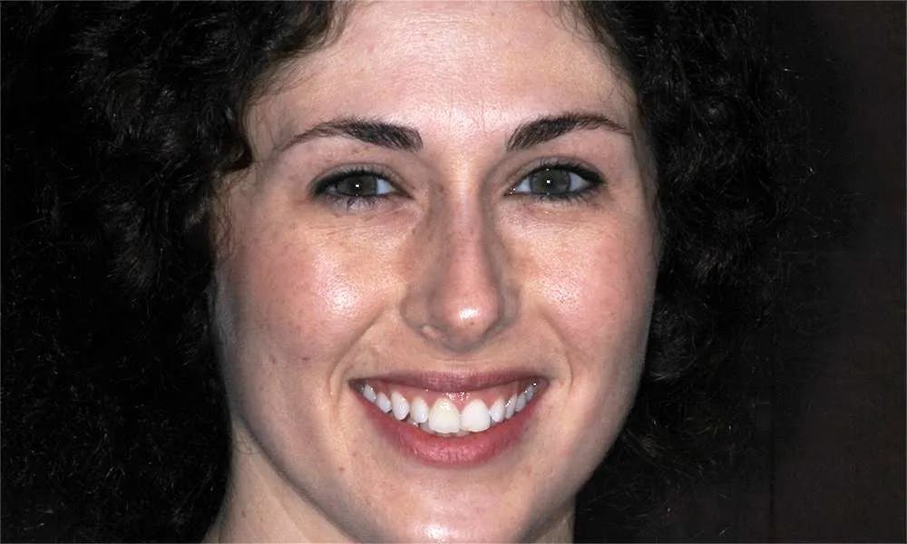 Patient five before and after image 1