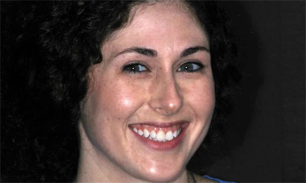 Patient five before and after image 2