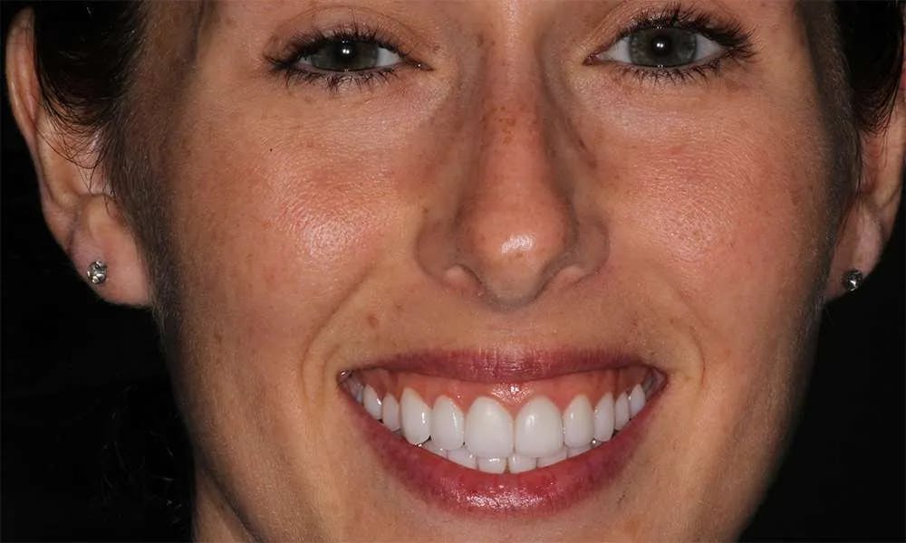 Patient five before and after image 7