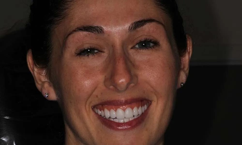 Patient five before and after image 8