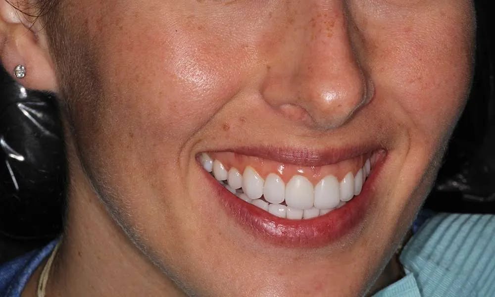 Patient five before and after image 9