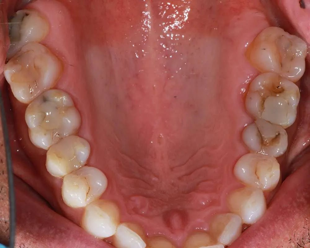 Patient six before and after image 1