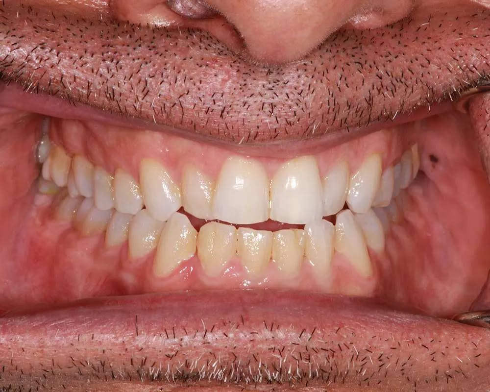 Patient six before and after image 3